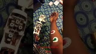 Design and Development of Human Bionic Arm by 3D Printing Technology