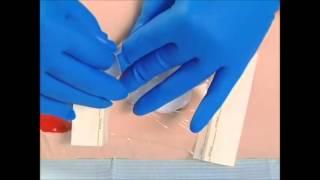 Transparent Film Wound Dressings | Autolytic Debridement Options | WoundEducators.com