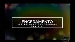 PARTE 3 ENCERAMENTO ANTERIOR