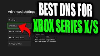 Best DNS Server For Xbox Series X/S (Faster internet for FREE by changing this one setting!)