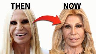 Donatella Versace's Stunning Comeback From Plastic Surgery Disaster