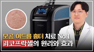 모공, 여드름 흉터 치료 No.1 피코프락셀의 모든 것 (원리, 효과, 주의사항) / 스킨부스터, 콜라겐부스터 비교분석