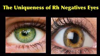 The Uniqueness of Rh Negatives Eyes