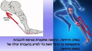 דורבן - טיפול בכאבי  ופציעות כף רגל ד"ר שמי שגיב כירופרקט מומחה טיפול בפציעות רפואת ספורט