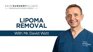 Surgical Lipoma Removal - See The Treatment