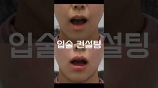 장원영 입술 만들어주세요 #입술필러 #입술컨설팅