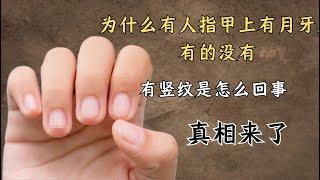 为什么有人指甲上有月牙，有的没有？有竖纹是怎么回事？真相来了| 中医养生｜身体调理｜气血疏通｜经络养生｜针灸理疗｜【中医针灸理疗师Jimmy】
