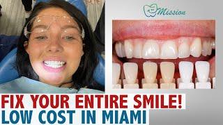 Fix Your Entire Smile !Low Cost In Miami