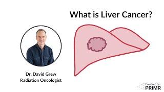 New Liver Cancer Diagnosis - What to Expect