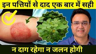 दाद एक बार में हो जायेगा सही | Home Remedy For Fungal Infection | Desi Dava For Daad