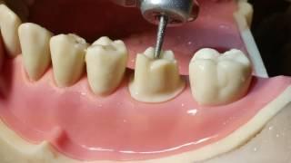 Molar Crown Preparation Walkthrough (tutorial) in the Simulation Lab