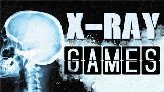 The Sick Joy of X-Ray Games