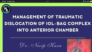 Management of Traumatic Dislocation of IOL-BAG Complex into Anterior Chamber. Dr. Necip Kara