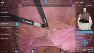 VirtaMed LaparoS™ - Vesicouterine Fold Dissection