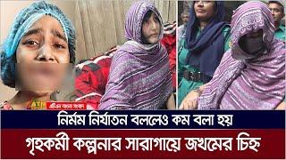 গৃহকর্মী কল্পনার সারাগায়ে জ*খ*মে*র চিহ্ন। ATN Bangla News