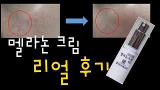 의약품 미백크림 , 멜라논 크림 리얼 후기 영상