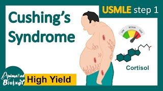 Cushing's syndrome | How is Cushing syndrome diagnosed? | Treatment of Cushing's syndrome | USMLE