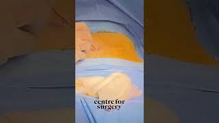 UMBILICOPLASTY SURGERY | LONDON UK | Centre for Surgery