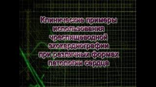 Чреспищеводная эхокардиография, клинические примеры при различной патологии сердца.