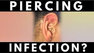 PIERCING INFECTIONS OR IRRITATION? | How Do I Know I Have One?