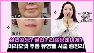 "실리프팅? 필러? 리프팅레이저?" 노안의 주범 마리오넷 입가주름 유형별 시술 총정리편