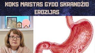 Koks maistas gydo skrandžio erozijas