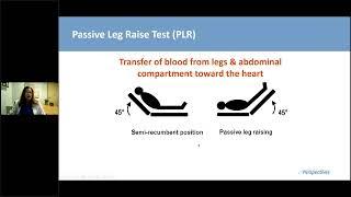 Sepsis  Are we doing enough for our patients