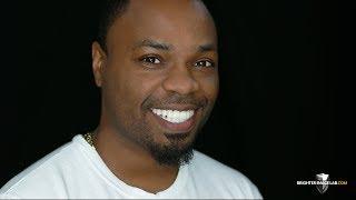 Brighter Image Lab -Tooth Contour & Dental Veneer Financing $149 dn.
