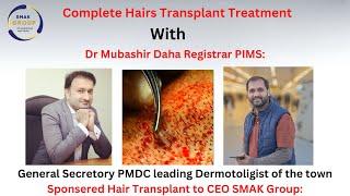 Hair Transplant || Treatment Expense || Experience || Tayyab Sethi CEO of Smak Group