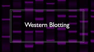 Western Blot Protocol Overview