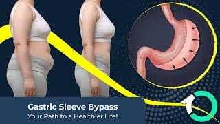  Gastric Sleeve Bypass in Istanbul – Transform Your Life with One Clinic!