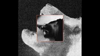 Hard Trap Beat - ''Detox" | Trap Type Beat (Prod. 808 Instinct)