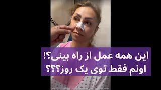 این همه عمل از بینی تو یک روز  - دکتر گیو شریفی و هیپوفیز