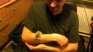 Man with killer hamster