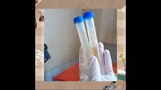 pemeriksaan mikroskopis urine