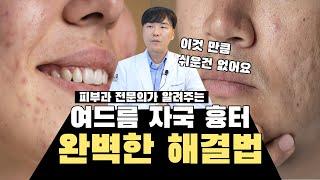 여드름 없애는 방법  생기는 원인과 해결방법 | 연세에이엔비피부과 이해진 원장