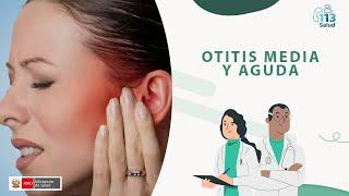 OTITIS MEDIA Y AGUDA