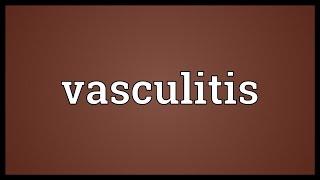 Vasculitis Meaning