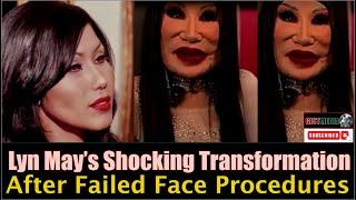 Lyn May’s Shocking Transformation After Failed Face Procedures