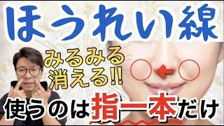 【ほうれい線】老け顔の原因にもなるほうれい線を理にかなった方法で解消する！