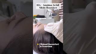 HA Skin Booster 水光针 | Define Aesthetic Medical Clinic