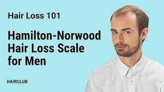 Hamilton-Norwood Hair Loss Scale for Men - Male Pattern Baldness