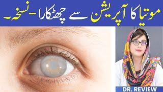 Cataract Treatment | Safed Motia Ka Ilaj | Home Remedy