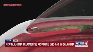 New glaucoma treatment is restoring eyesight in Oklahoma