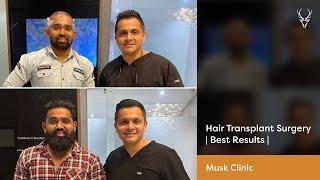 Hair Transplant in Ahmedabad| Cost of Hair Transplant | Best Results