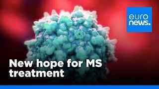 Discovery about regulatory T cells could help treat diseases such as MS | euronews 