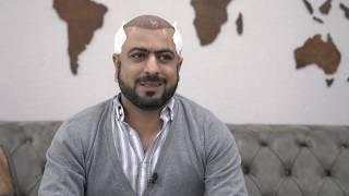 Hair Transplant Journey of Wessam from Finland! [January 2019!]