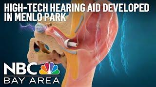 Doctors call high-tech hearing aid developed in Menlo Park a 'game-changer'