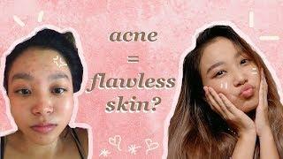 how to get flawless skin when you have acne