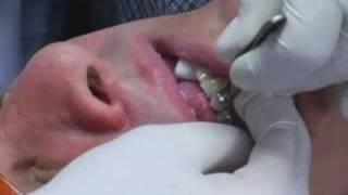 Orthodontic Jaw Wiring for Weight Loss - Part One